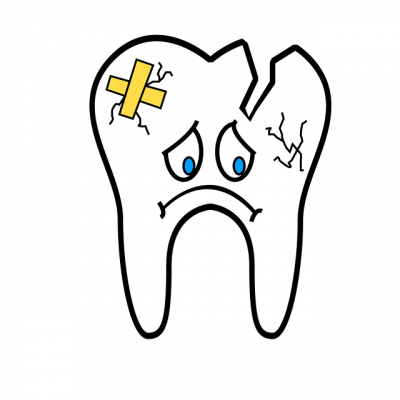 broken tooth 2351797_640 2 1 